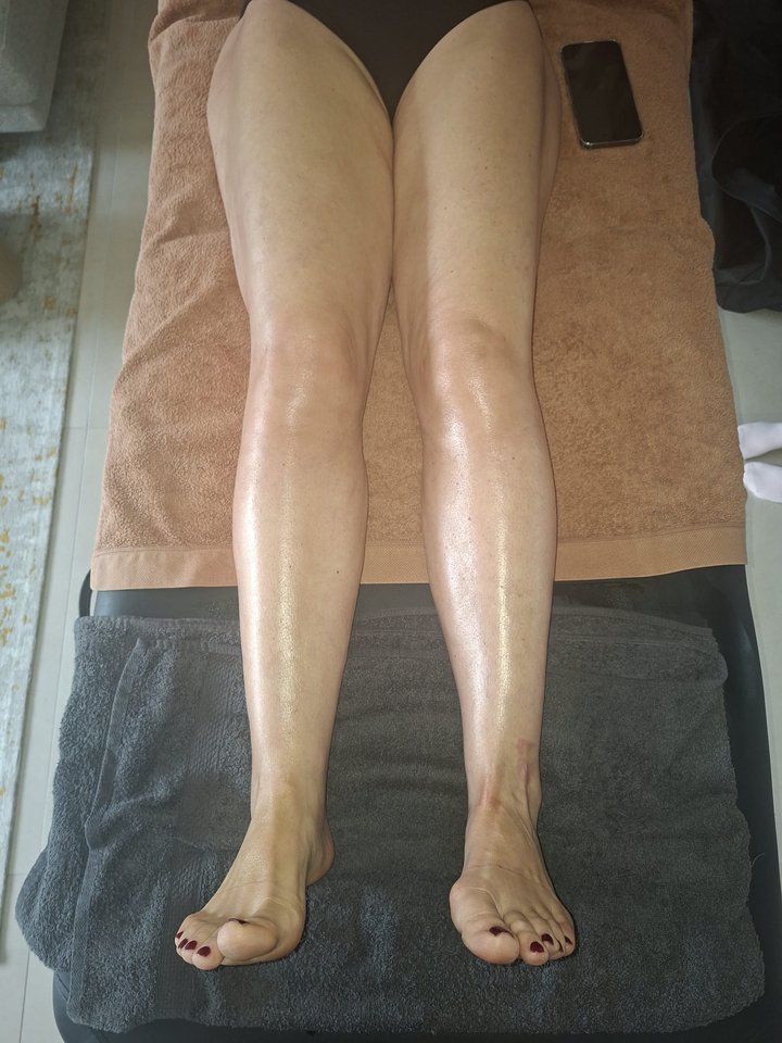 Séance de drainage lymphatique sur les jambes